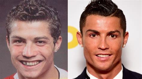Top Cristiano Ronaldo Avant Chirurgie Of All Time Access Here