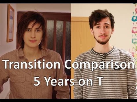 Ftm Transgender Years On Testosterone Comparison Youtube