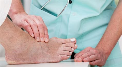 What To Expect Before And After Minimally Invasive Bunion Surgery