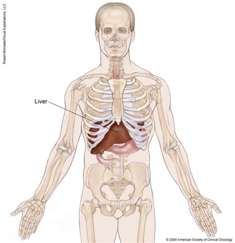 Liver Cancer Medical Illustrations Cancernet