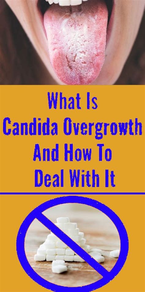 What Is Candida Overgrowth And How To Deal With It Health And