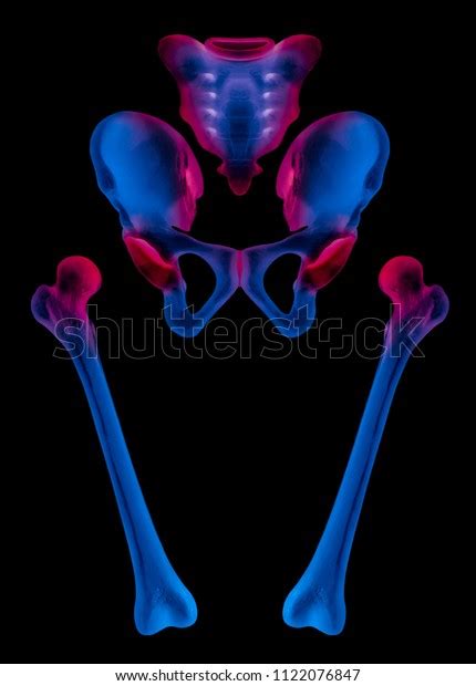Xray Separate Human Hip Femur Bone Stock Illustration 1122076847
