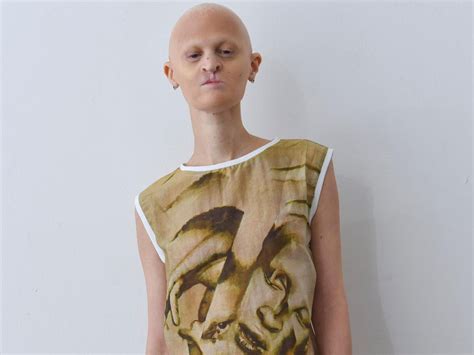 Melanie Gaydos The Model With A Rare Genetic Disorder Breaking Every Rule In Fashion The