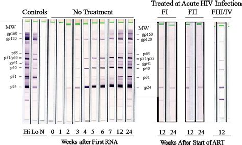 Left Evolution Of Hiv 1 Western Blot Wb Assay Profiles Of An