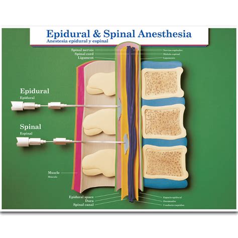 The Epidural And Spinal Anesthesia Are Shown In This Diagram