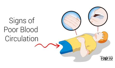 10 Warning Signs Of Poor Blood Circulation Top 10 Home Remedies