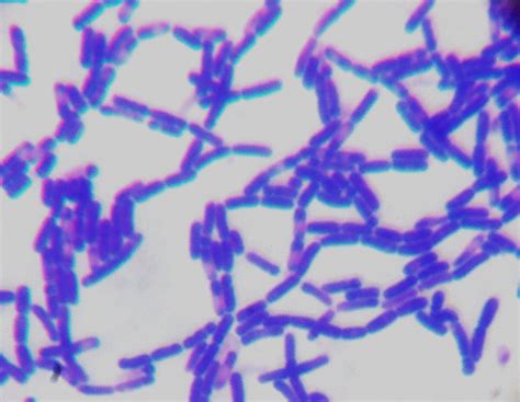 As gram positive bacteria lack an outer lipid membrane, when correctly referring to their structure rather than staining properties, are termed monoderms. How can I identify these three types of gram positive ...