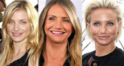 Cameron Diaz Plastic Surgery Before And After Pictures 2020