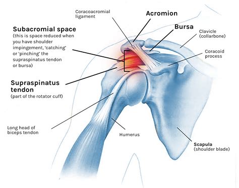Diagram Of Shoulder Impingement Anatomy Of Shoulder Impingement