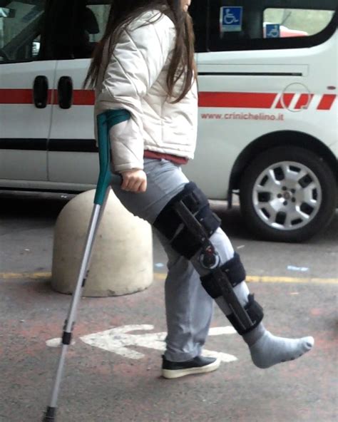 Italian Legcast Crutching Wheelchair Sprain Casts Braces Sprain Cnews