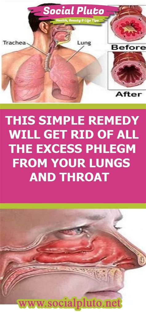 This Simple Remedy Will Get Rid Of All The Excess Phlegm From Your Lungs And Throat Lunges