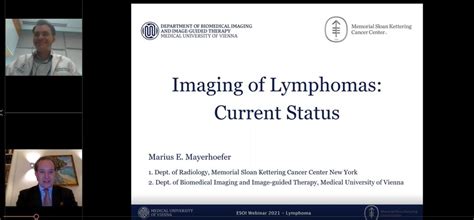 Imaging Of Lymphomas Current Status 2021 Esoi