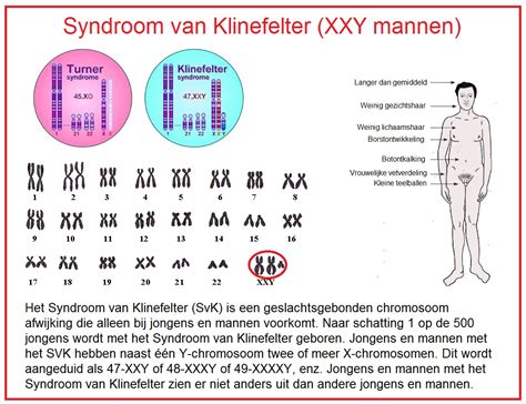 Syndroom Van Klinefelter Oorzaak Symptomen Diagnose Behandeling My