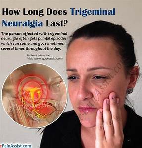Trigeminal Neuralgia Referred Tooth Chart