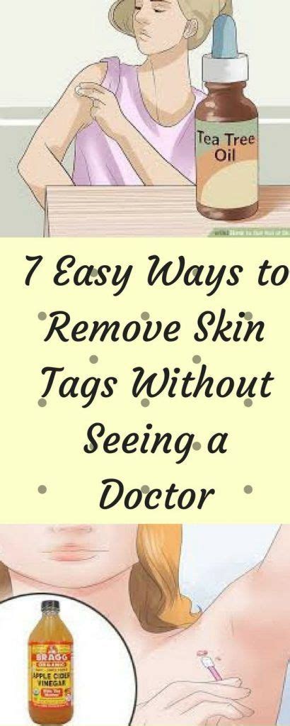 7 easy ways to remove skin tags without seeing a doctor health diy blog