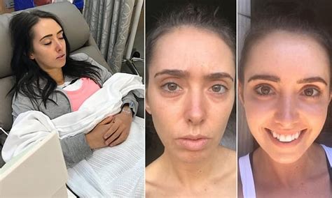 How One Nsw Womans Breast Implants Poisoned Her From The Inside