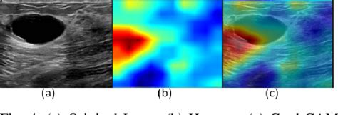 Figure 4 From Comparative Analysis Of Transfer Learning And Customized