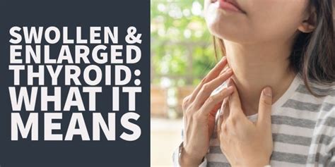 Swollen And Enlarged Thyroid What It Means And What Causes It