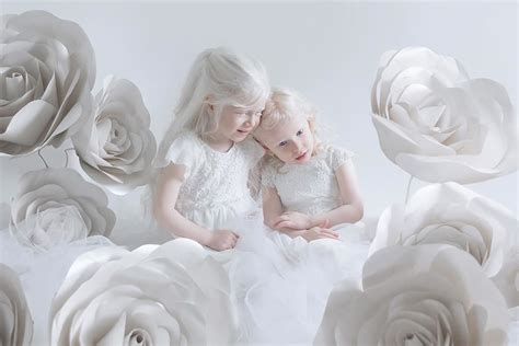 Albino People S Beauty Photos By Yulia Taits Cheer Pick