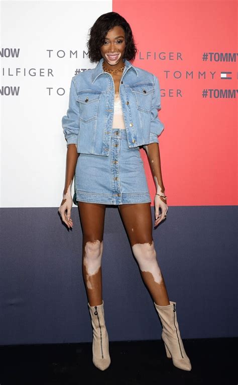 Winnie Harlow Shares Her Truth Amid Antm Controversy E Online Ca