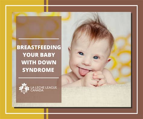 Breastfeeding Your Baby With Down Syndrome La Leche League Canada