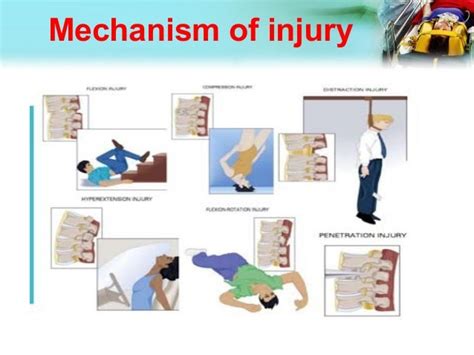 ‫spinal Injury