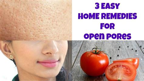 Home Remedy For Open Pores Shrink And Close Large Pores With Diy Face