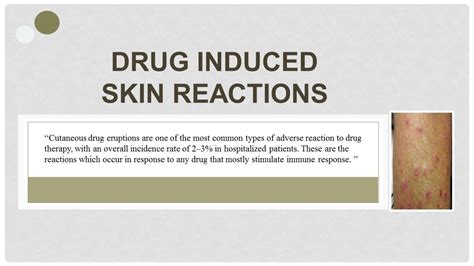Drug Induced Skin Reactions With Types 🏥 Youtube
