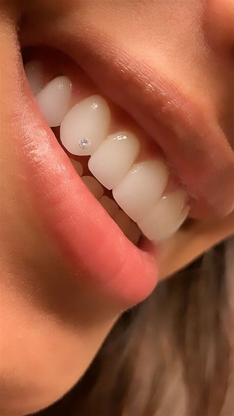 Teethjewelry Toothgem Veneers Dental Jewelry Teeth Jewelry Dope