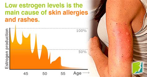 Skin Allergies And Rashes During Menopause