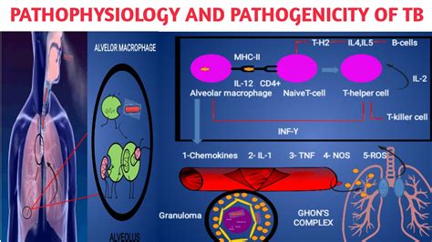 Pathophysiology Pathogenicity Of Mycobacterium Tuberculosis II Primary