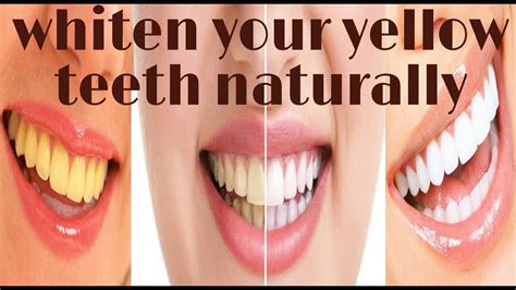 Whiten Your Teeth Naturally Only In Minutes Youtube