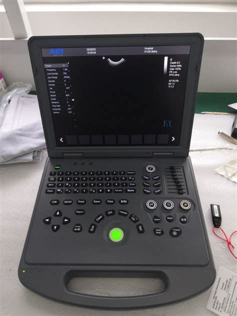 Laptop 4d Color Doppler Ultrasound Scanner Am 580a Apicalmed