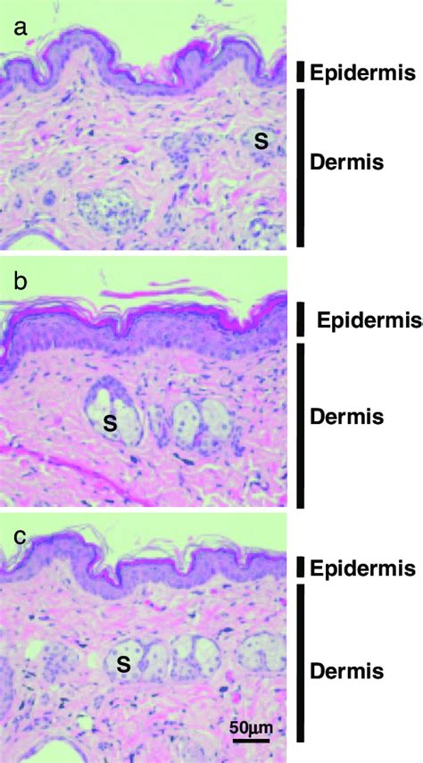 Mouse Skin Histology