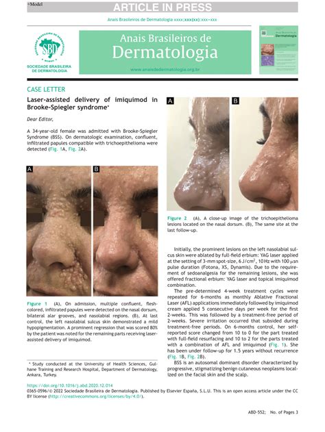Pdf Laser Assisted Delivery Of Imiquimod In Brooke Spiegler Syndrome