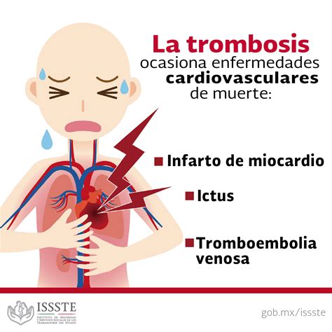 Kondisi ini bisa menghambat aliran darah ke organ tubuh tertentu sehingga berpotensi menyebabkan kondisi. ISSSTE on Twitter: "¿#Sabíasque la trombosis es la ...