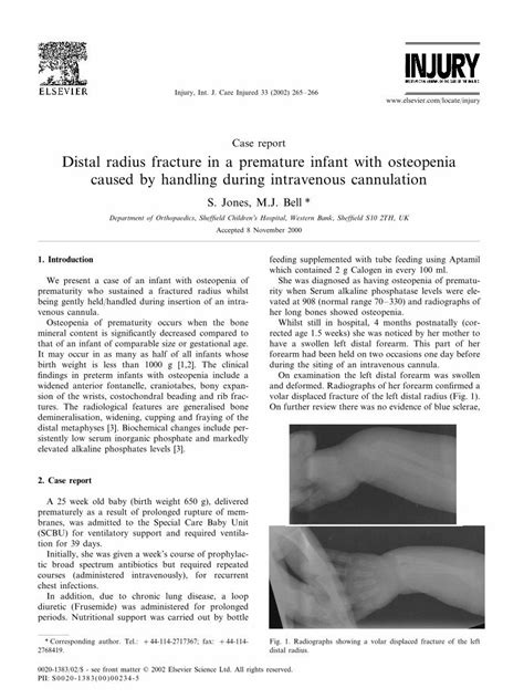 Pdf Distal Radius Fracture In A Premature Infant With Osteopenia Caused By Handling During