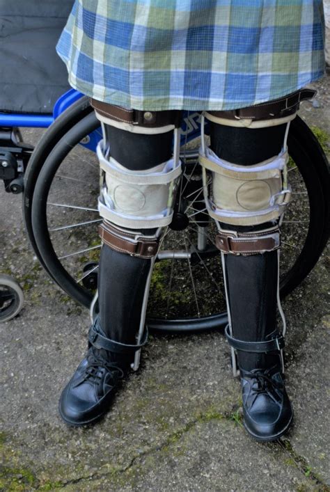 Pin On Orthopedic Devices Leg Braces Polio Shortleg