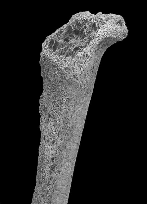 A Detail Of The Left Femur Diaphysis With Deposit Of The New Formed