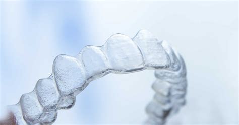 Is Invisalign Available Through The Nhs Nhs Invisalign Sensu