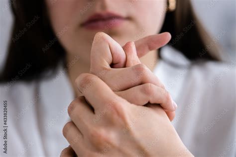 Hand Knuckle Finger Joint Crack Stock Photo Adobe Stock