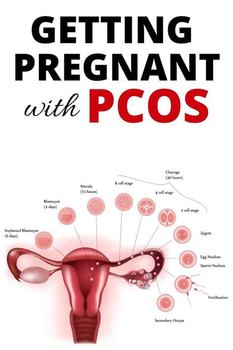 Getting Pregnant With Pcos Yes Its Possible For You Too