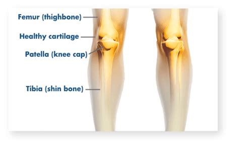 Why Do I Have Knee Pain Dr Nicholas Connors Port