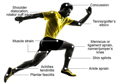 what are sports injuries the complete guide osteocare