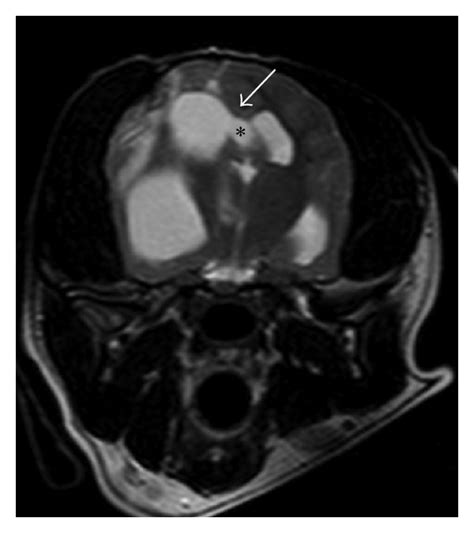 Preoperative Magnetic Resonance Mr Images Of The Head A