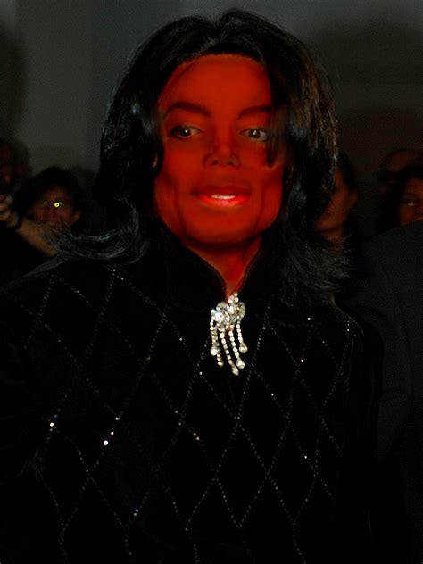 Michael Jackson Without Vitiligo By Simplydarkerthandeaf
