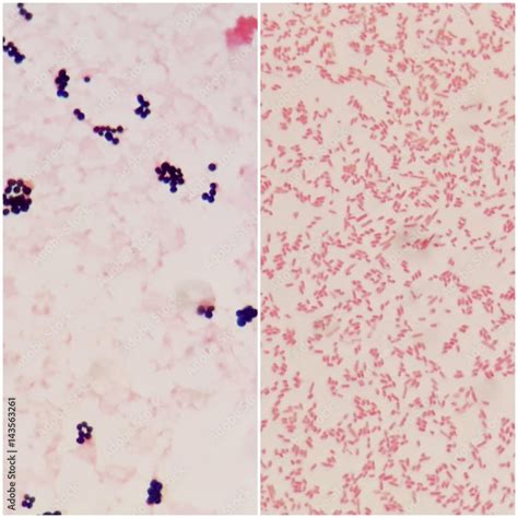 Obraz Smear Of Gram Positive Bacteria On The Left And Gram Negative