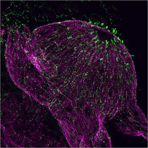 The Nervous System Of Hydra Is A Diffuse Nerve Net Here A Population