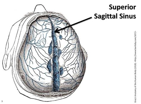 Relationship Of Superior Sagittal Sinus With Sagittal Vrogue Co