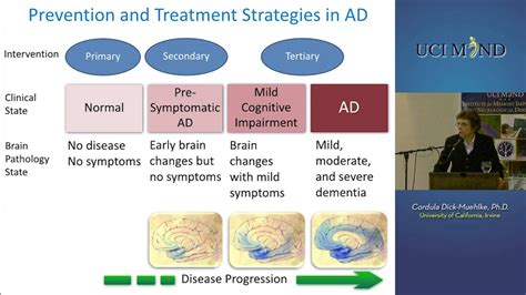 Uci Mind Advances In Alzheimers Disease Treatment Current And